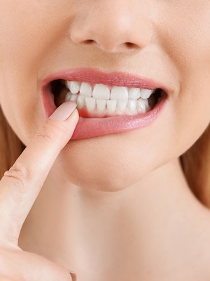 Gum Disease Treatment